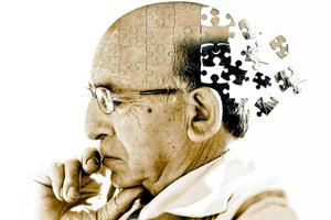 Test Alzheimer